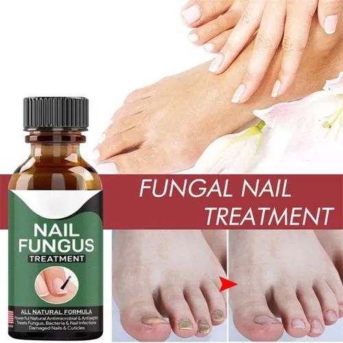 Nail Fungal Treatments Nail Repair Essences Serum 10ml